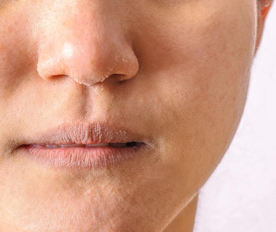 علائم کم‌آبی و دهیدراته شدن پوست